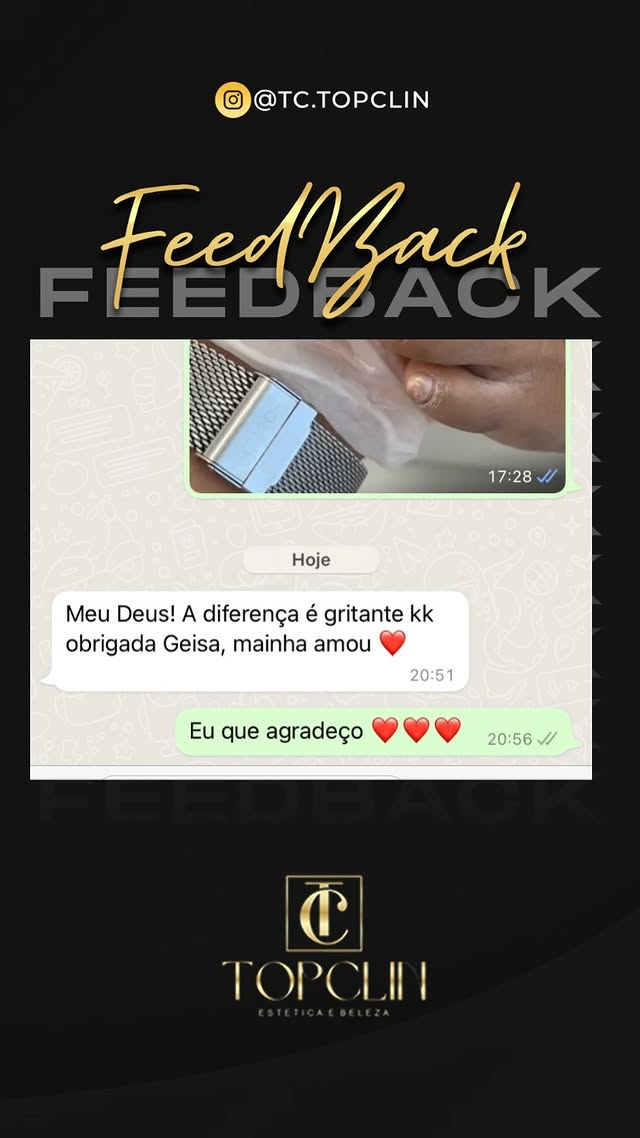 Cliente comenta a diferença gritante após atendimento de podologia