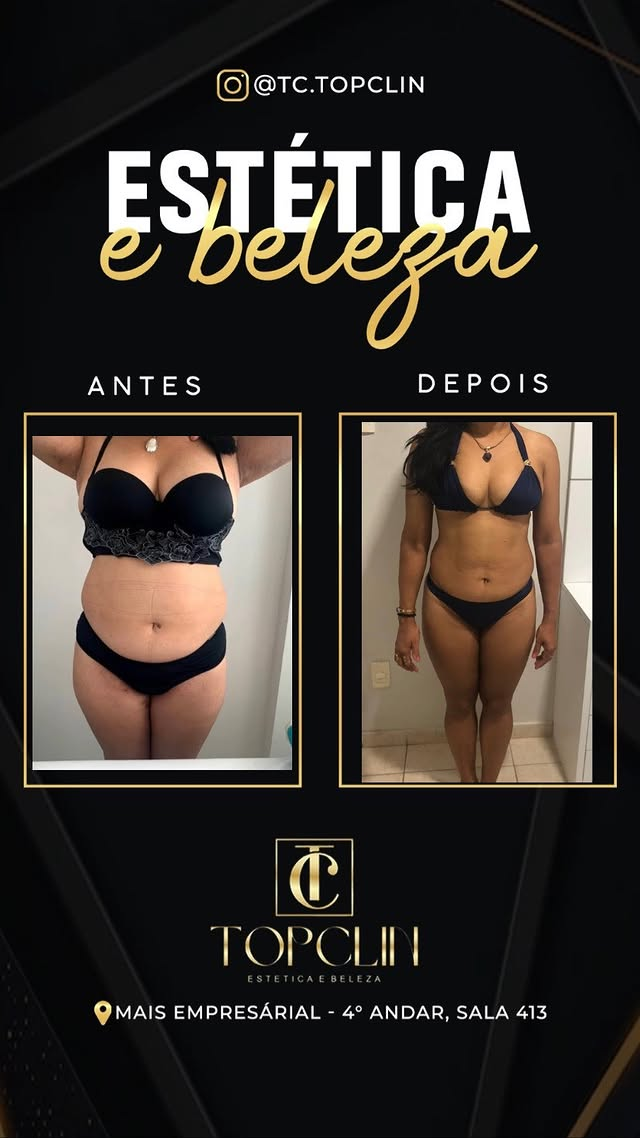 Antes e depois de transformação corporal de cliente da TopClin